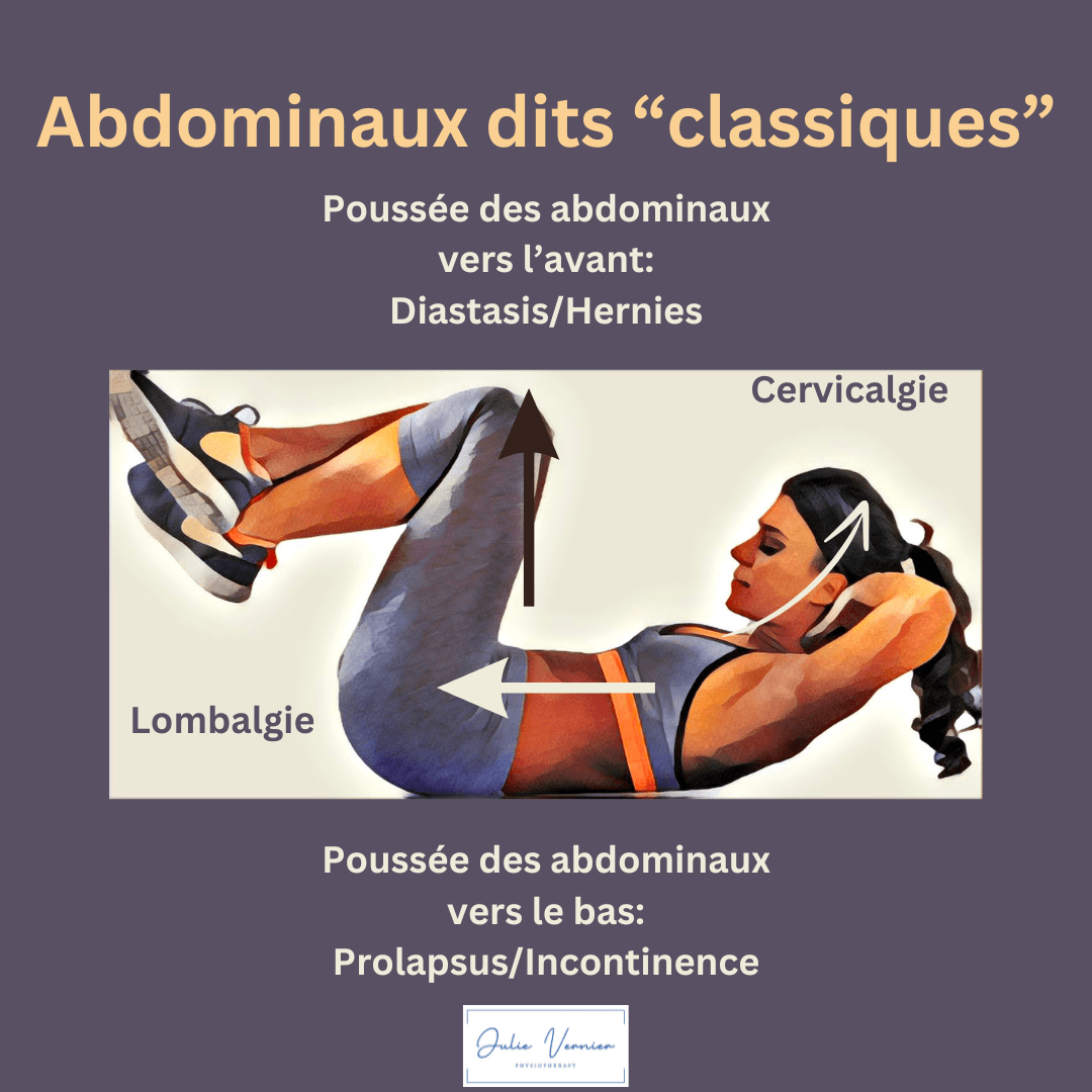 Infografía: efectos de los abdominales clásicos en el cuerpo